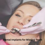 Dental Implants for Missing Teeth by Dent-O-Care