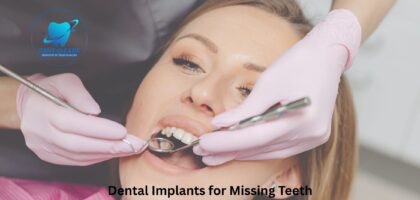 Dental Implants for Missing Teeth by Dent-O-Care