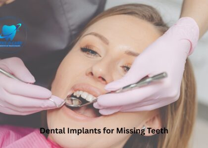 Dental Implants for Missing Teeth by Dent-O-Care