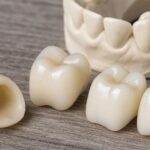 Top 10 Strong Reasons Why Choose Zirconia Crown