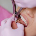 Reasons for Dental Implants for Missing Teeth