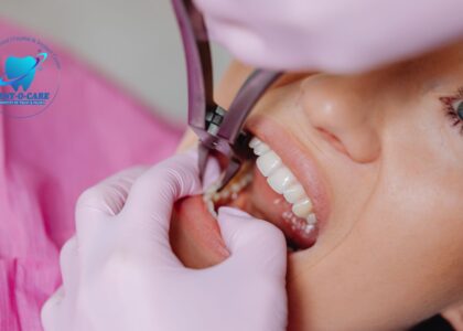 Reasons for Dental Implants for Missing Teeth