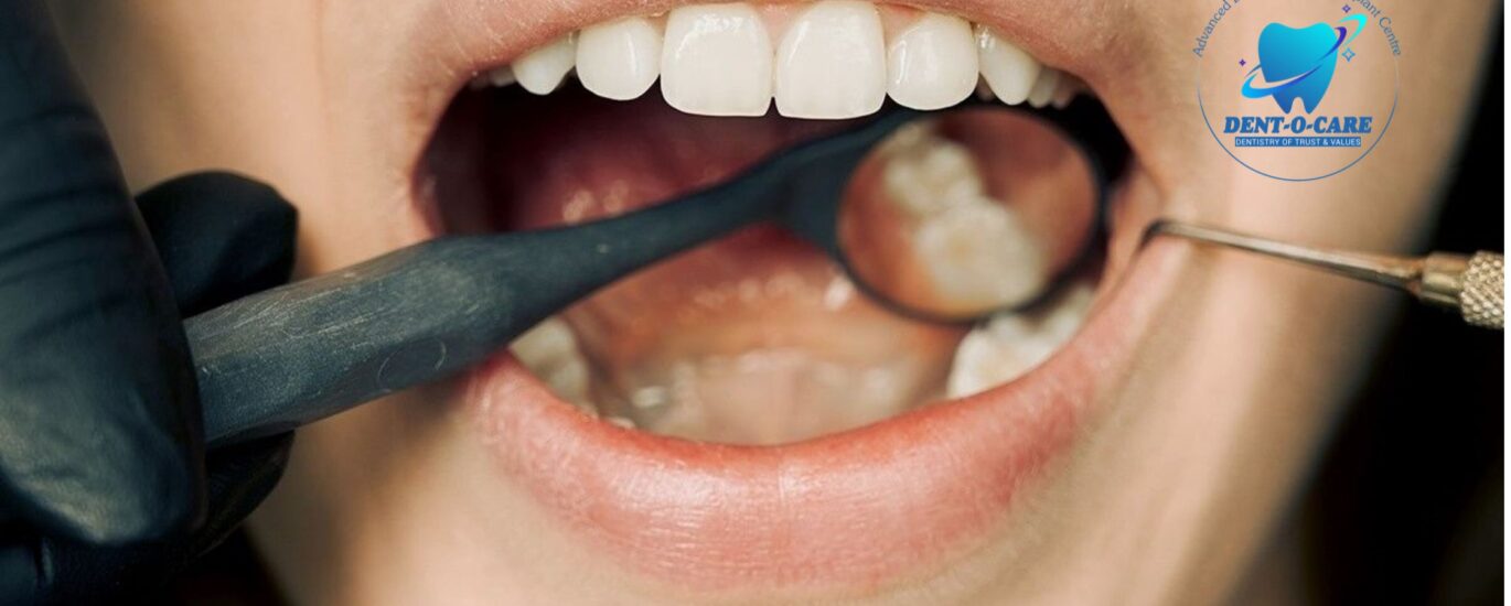Optimal Oral Health
