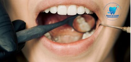 Optimal Oral Health