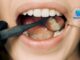 Optimal Oral Health
